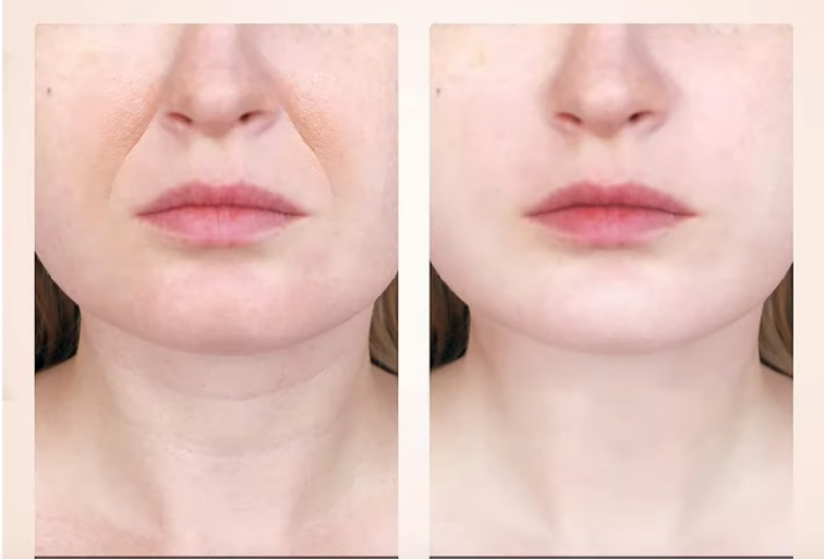 Masseur du cou et du visage à micro-courant - Boutique Ecom